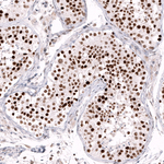 EZH2 Antibody in Immunohistochemistry (Paraffin) (IHC (P))