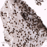 EZH2 Antibody in Immunohistochemistry (Paraffin) (IHC (P))