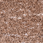 EZH2 Antibody in Immunohistochemistry (Paraffin) (IHC (P))