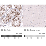 EZH2 Antibody in Immunohistochemistry (Paraffin) (IHC (P))