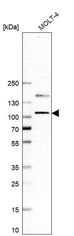 EZH2 Antibody in Western Blot (WB)