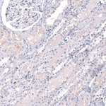 EZH2 Antibody in Immunohistochemistry (Paraffin) (IHC (P))