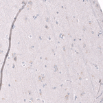 EZH2 Antibody in Immunohistochemistry (Paraffin) (IHC (P))