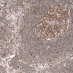 EZH2 Antibody in Immunohistochemistry (Paraffin) (IHC (P))