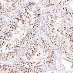 EZH2 Antibody in Immunohistochemistry (Paraffin) (IHC (P))