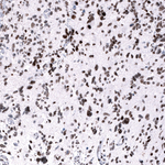 EZH2 Antibody in Immunohistochemistry (Paraffin) (IHC (P))