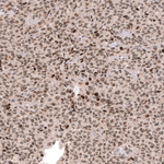 EZH2 Antibody in Immunohistochemistry (Paraffin) (IHC (P))
