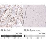 EZH2 Antibody in Immunohistochemistry (Paraffin) (IHC (P))