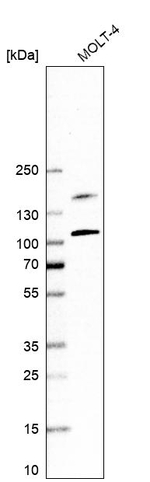 EZH2 Antibody in Western Blot (WB)