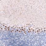 Calbindin D28K Antibody in Immunohistochemistry (Paraffin) (IHC (P))