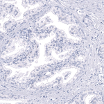 Calbindin D28K Antibody in Immunohistochemistry (Paraffin) (IHC (P))