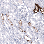 Calbindin D28K Antibody in Immunohistochemistry (Paraffin) (IHC (P))