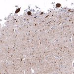 Calbindin D28K Antibody in Immunohistochemistry (Paraffin) (IHC (P))