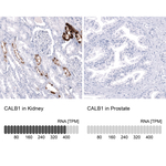 Calbindin D28K Monoclonal Antibody (CL15065)