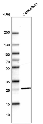 Calbindin D28K Antibody in Western Blot (WB)