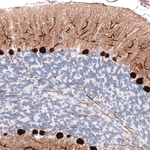Calbindin D28K Antibody in Immunohistochemistry (Paraffin) (IHC (P))