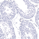 Calbindin D28K Antibody in Immunohistochemistry (Paraffin) (IHC (P))