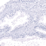 Calbindin D28K Antibody in Immunohistochemistry (Paraffin) (IHC (P))