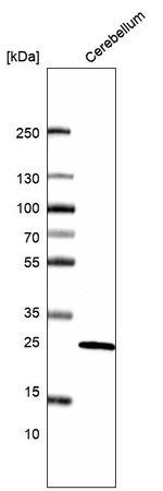 Calbindin D28K Antibody in Western Blot (WB)