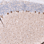 Calbindin D28K Antibody in Immunohistochemistry (Paraffin) (IHC (P))
