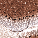 Calbindin D28K Antibody in Immunohistochemistry (Paraffin) (IHC (P))