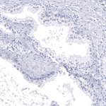 Calbindin D28K Antibody in Immunohistochemistry (Paraffin) (IHC (P))