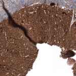 Calbindin D28K Antibody in Immunohistochemistry (Paraffin) (IHC (P))