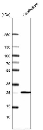 Calbindin D28K Antibody in Western Blot (WB)