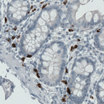 MMP9 Antibody in Immunohistochemistry (Paraffin) (IHC (P))