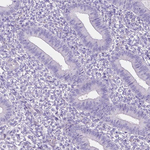 MMP9 Antibody in Immunohistochemistry (Paraffin) (IHC (P))