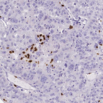 MMP9 Antibody in Immunohistochemistry (Paraffin) (IHC (P))