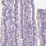 MMP9 Antibody in Immunohistochemistry (Paraffin) (IHC (P))
