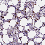 MMP9 Antibody in Immunohistochemistry (Paraffin) (IHC (P))