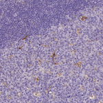 MMP9 Antibody in Immunohistochemistry (Paraffin) (IHC (P))