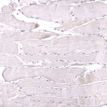 MSH6 Antibody in Immunohistochemistry (Paraffin) (IHC (P))