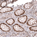MSH6 Antibody in Immunohistochemistry (Paraffin) (IHC (P))