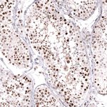 MSH6 Antibody in Immunohistochemistry (Paraffin) (IHC (P))