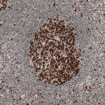 MSH6 Antibody in Immunohistochemistry (Paraffin) (IHC (P))
