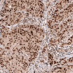 MSH6 Antibody in Immunohistochemistry (Paraffin) (IHC (P))