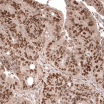 MSH6 Antibody in Immunohistochemistry (Paraffin) (IHC (P))