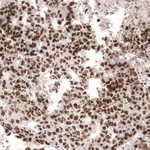 MSH6 Antibody in Immunohistochemistry (Paraffin) (IHC (P))