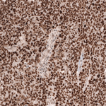 MSH6 Antibody in Immunohistochemistry (Paraffin) (IHC (P))