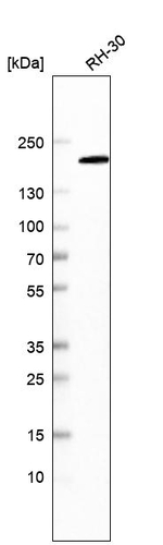 MSH6 Antibody in Western Blot (WB)