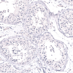 Cytokeratin 14 Antibody in Immunohistochemistry (Paraffin) (IHC (P))