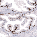 Cytokeratin 14 Antibody in Immunohistochemistry (Paraffin) (IHC (P))