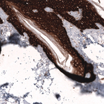 Cytokeratin 14 Antibody in Immunohistochemistry (Paraffin) (IHC (P))
