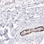 Cytokeratin 14 Antibody in Immunohistochemistry (Paraffin) (IHC (P))