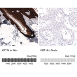 Cytokeratin 14 Antibody in Immunohistochemistry (Paraffin) (IHC (P))