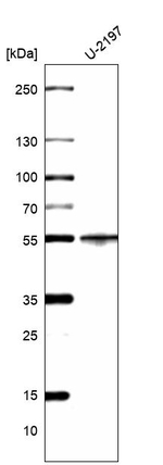 Cytokeratin 14 Antibody in Western Blot (WB)
