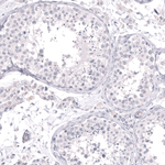 Cytokeratin 14 Antibody in Immunohistochemistry (Paraffin) (IHC (P))